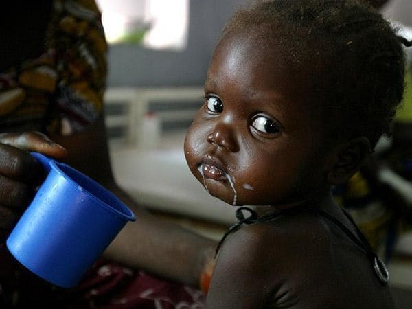 17 millones de niños sufren desnutrición aguda grave en el mundo